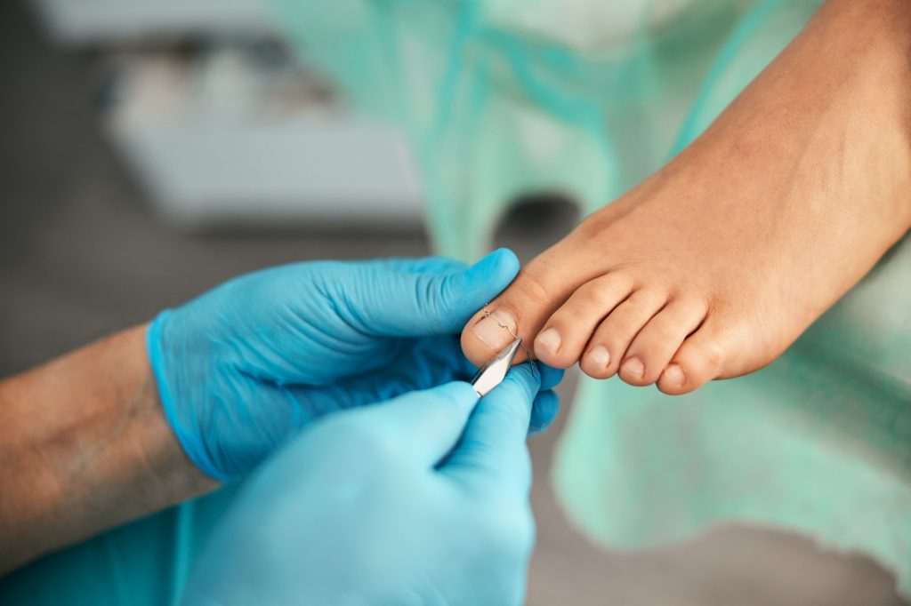 Close up of doctor doing medical pedicure